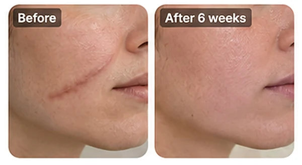 Facial scar comparison