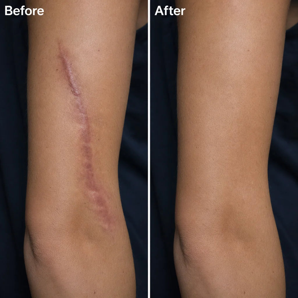 Scar appearance comparison