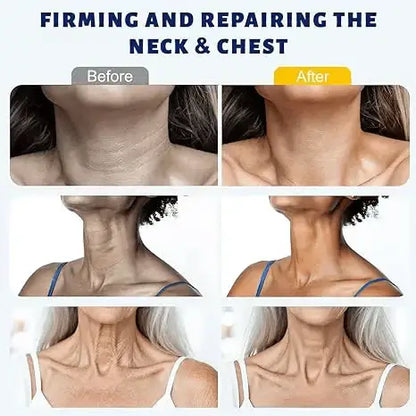 ✨ Instant Neck Lift Cream — 🧴 Infused with Retinol & Hyaluronic Acid | Firms the Neck, Reduces Wrinkles & Double Chin