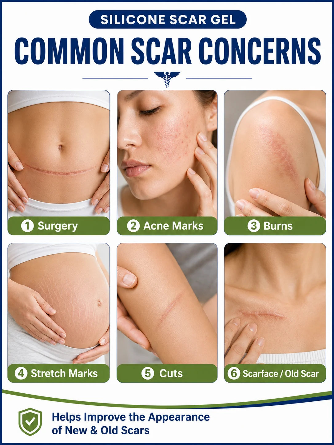 Skin scar comparison