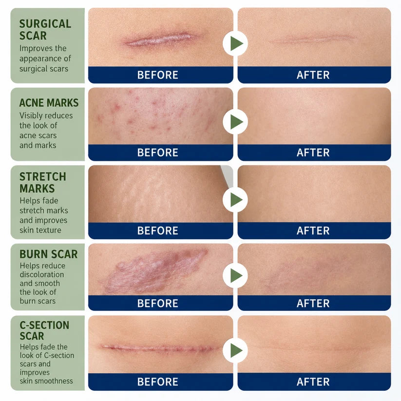 Scar care applications
