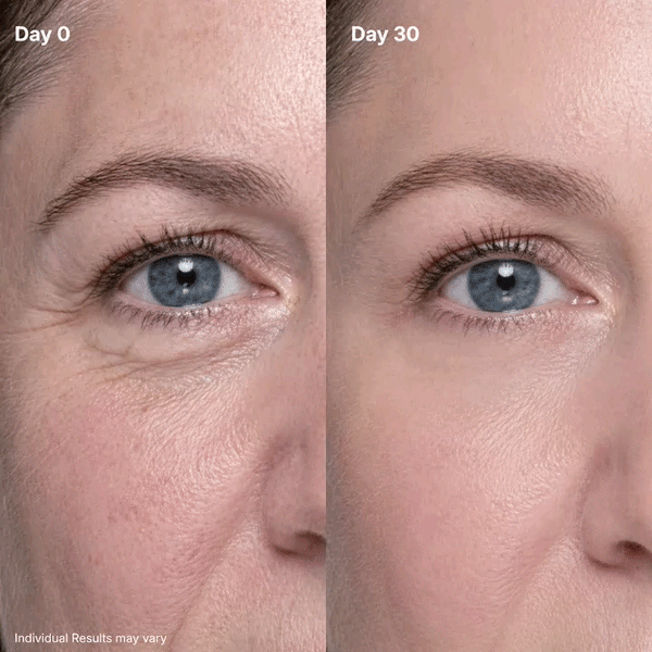 🔥Final 2 Hour BUY 1 GET 1 FREE! 🔥  Fast-Acting Anti-Aging & Firming Eye Cream