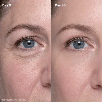 🔥Final 2 Hour BUY 1 GET 1 FREE! 🔥  Fast-Acting Anti-Aging & Firming Eye Cream